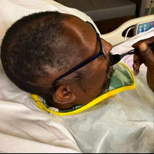 A synthetic piece of bone was made to fill the hole left in his skull. Credit: Hornsby Law Group 