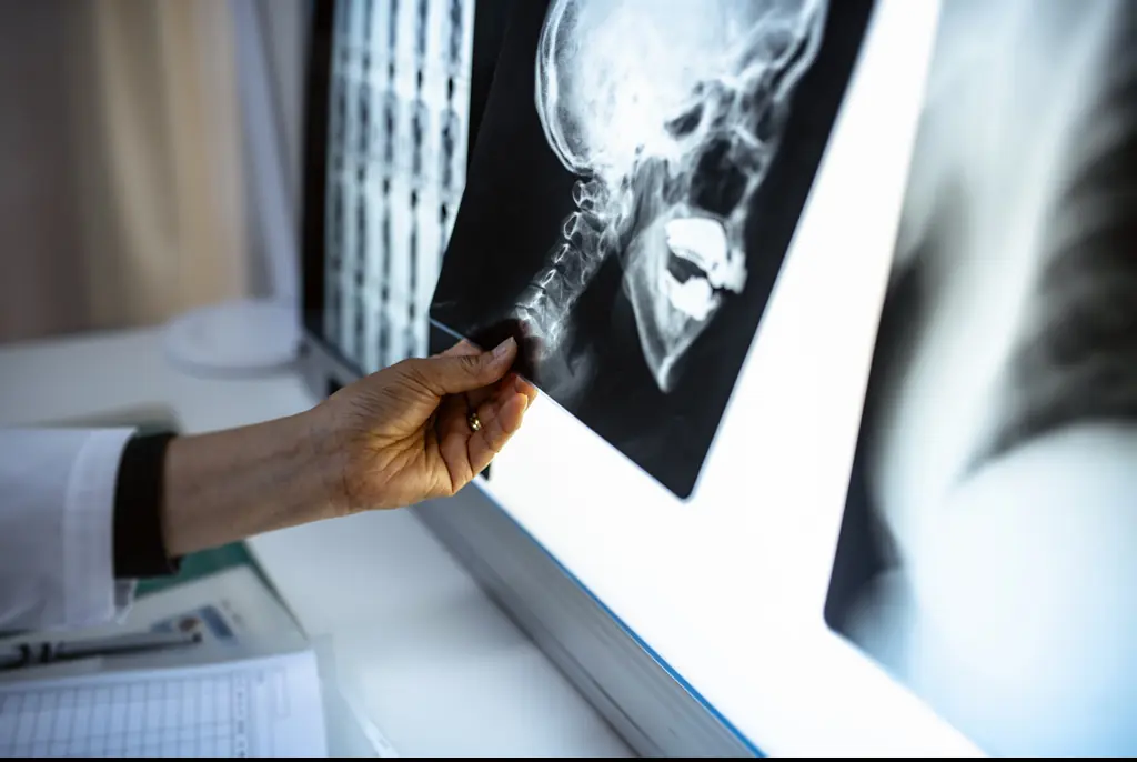 A synthetic piece of skull was made after his original bone flap was lost. Credit: AzmanJaka/Getty Images 