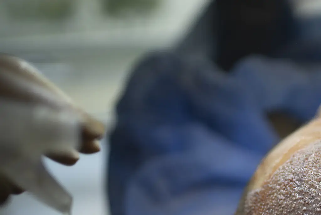 Man, 38, dies after undergoing hair transplant overseas - police investigation launched