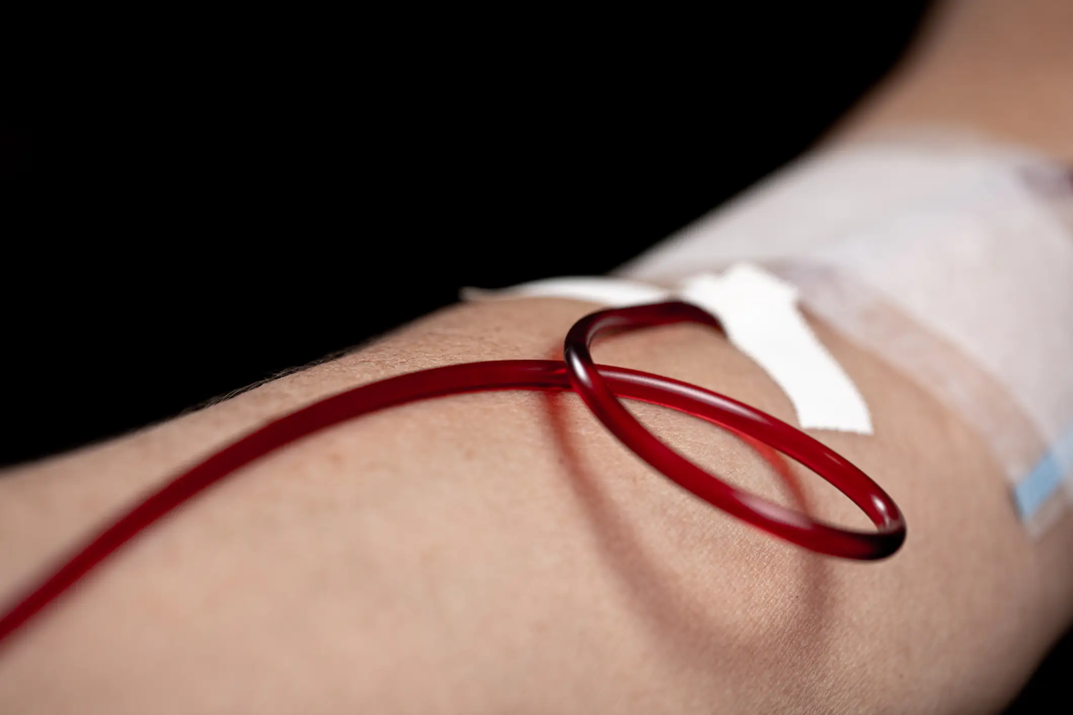 Woman donated kidney to her boss and then the boss fired her, she says