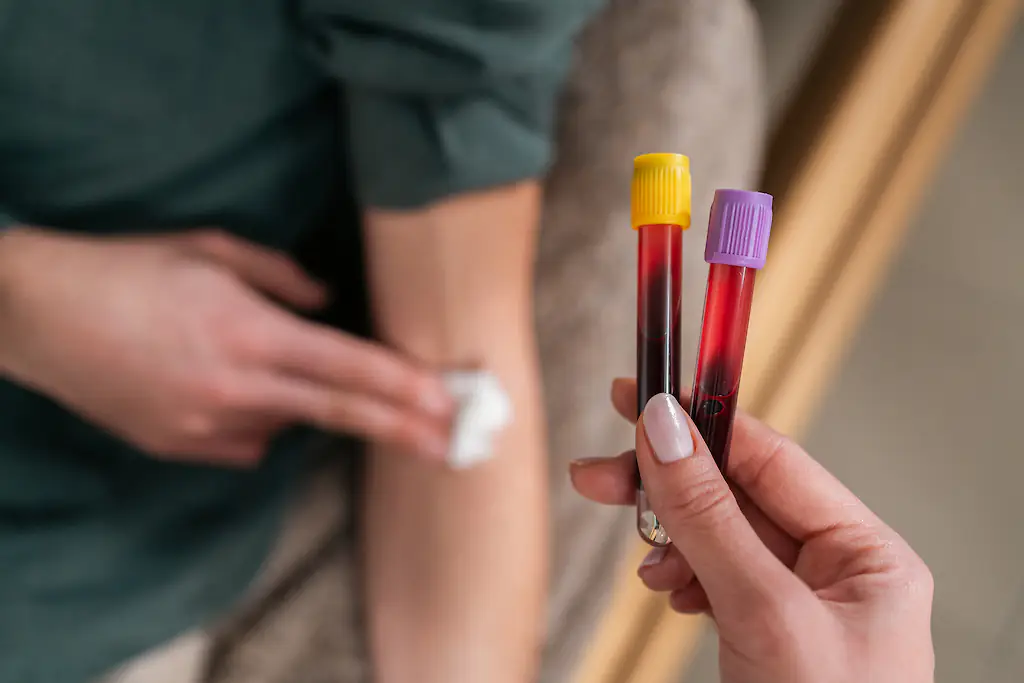 Researchers want to increase the supply of Rh-null blood for transfusions by growing it in a lab. Credit: FluxFactory / Getty