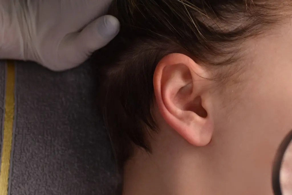 Mom issues warning after popping pimple in ‘triangle of death’ and ending up needing urgent care