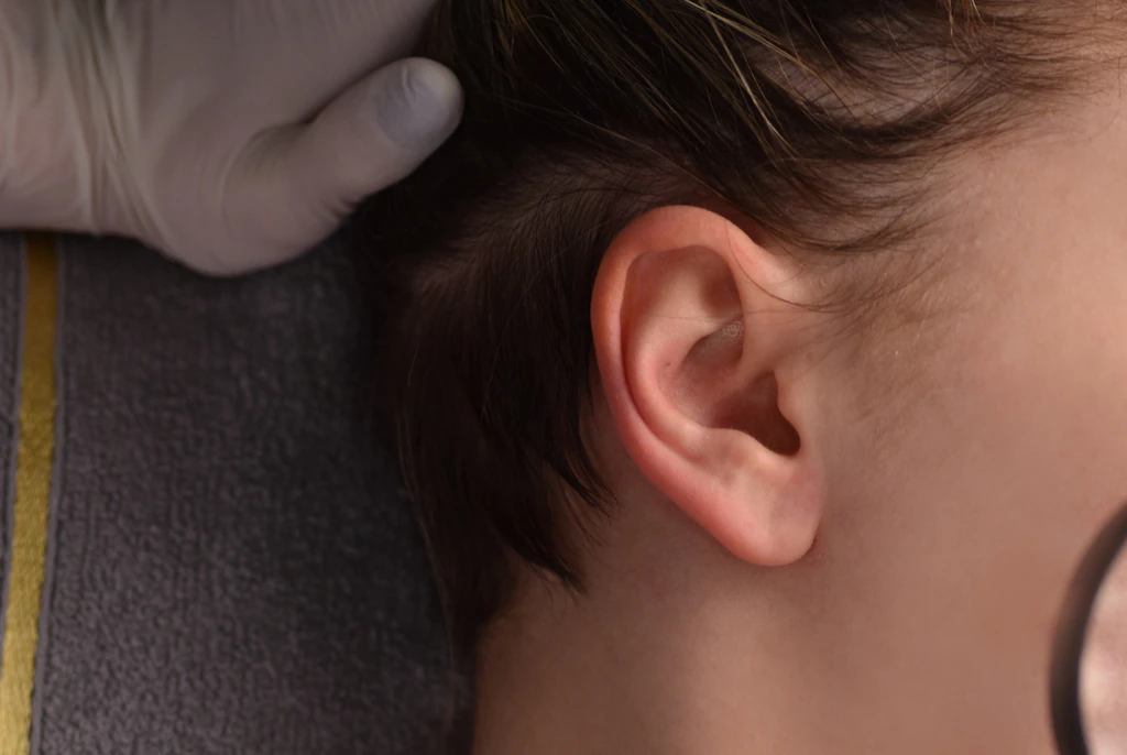 Mom issues warning after popping pimple in ‘triangle of death’ and ending up needing urgent care