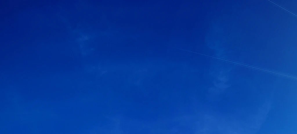 Girl, 7, is forced to cover every inch of her skin when outside due to devastating rare condition