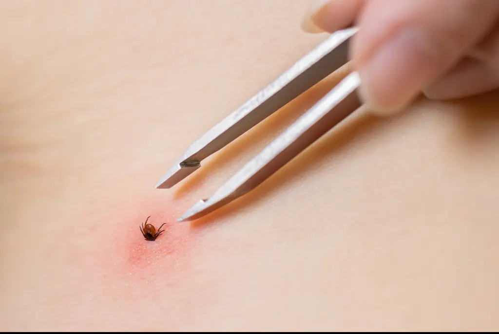 Credit: rbkomar / Getty