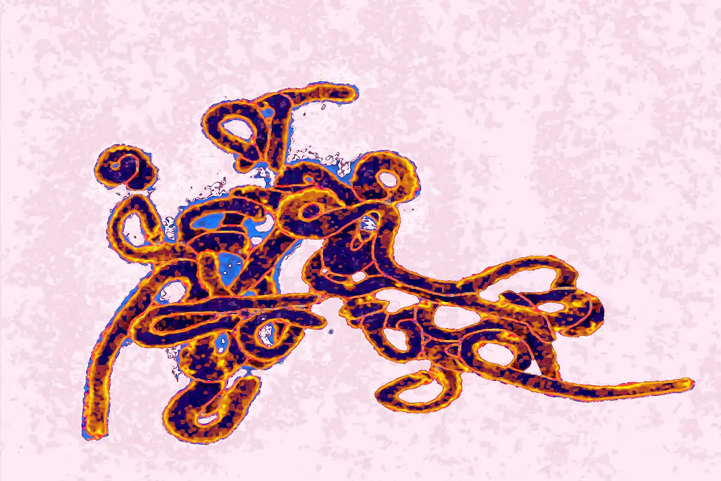 At least six American nationals have been exposed to the Ebola virus in the Democratic Republic of Congo. Credit: BSIP/Getty