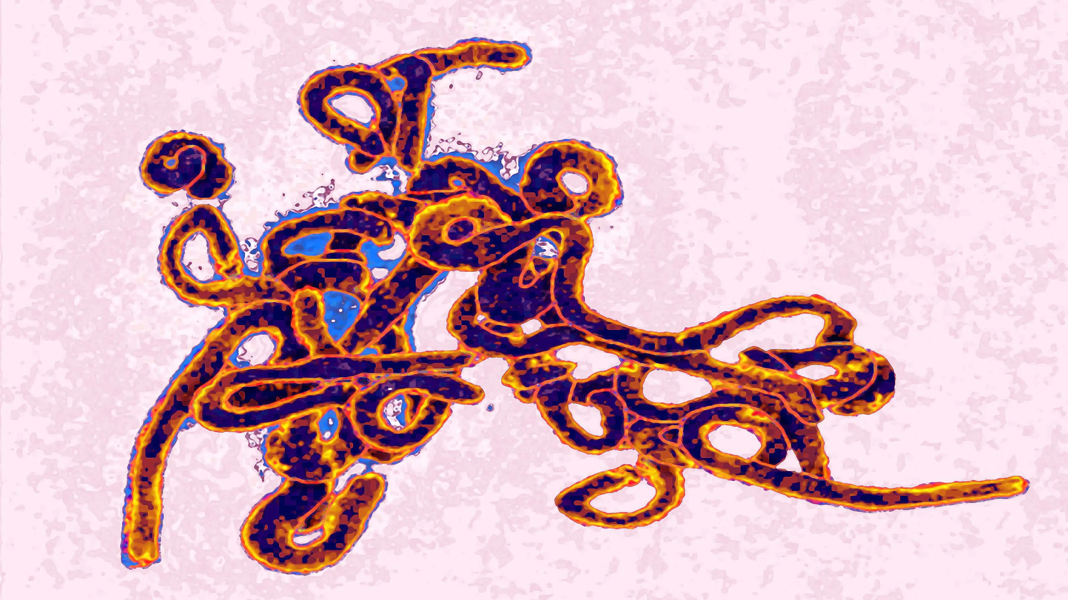 Ebola Virus under a microscope. Credit: BSIP/Getty