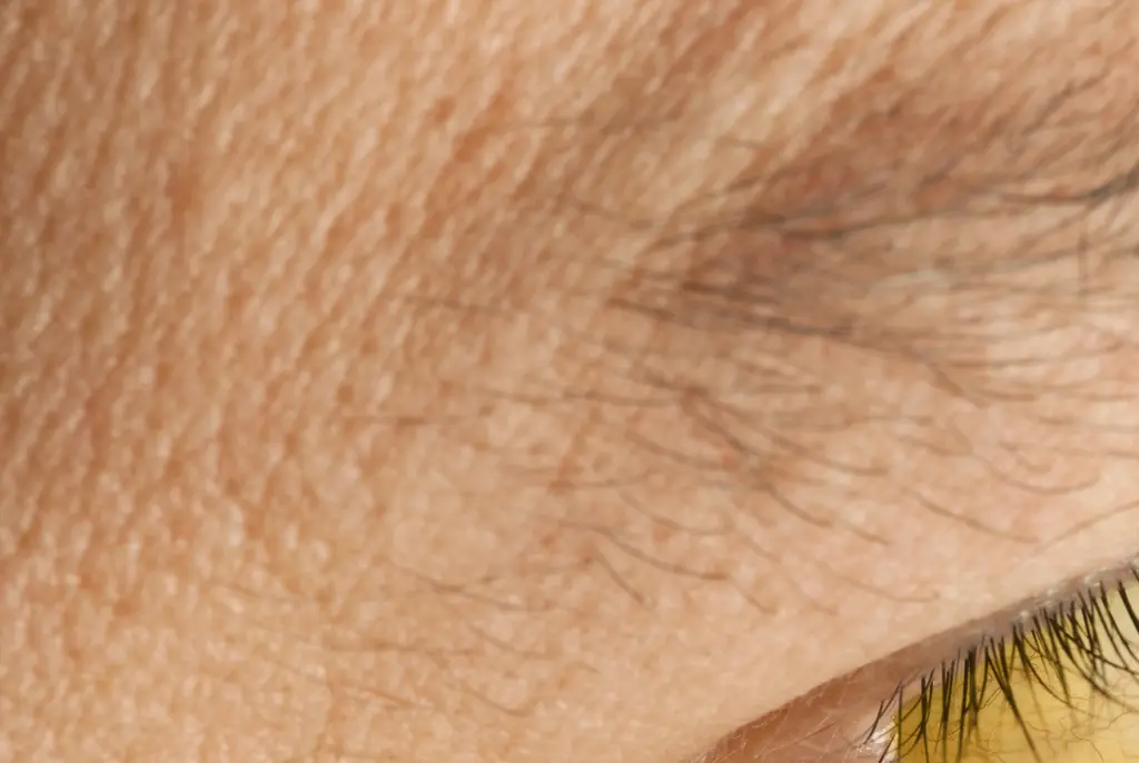 Subtle skin change that can reveal a person has one of the deadliest types of cancer