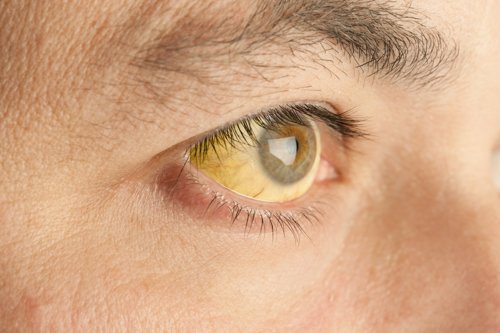 Subtle skin change that can reveal a person has one of the deadliest types of cancer