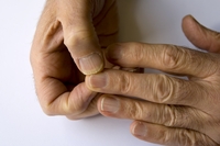 Man is urged to go to the doctor 'immediately' after sharing a photo of his fingernail
