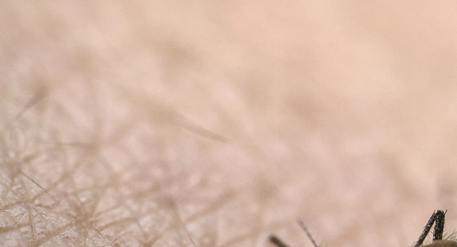 Symptoms of Chikungunya virus as China responds with 'Covid like measures'