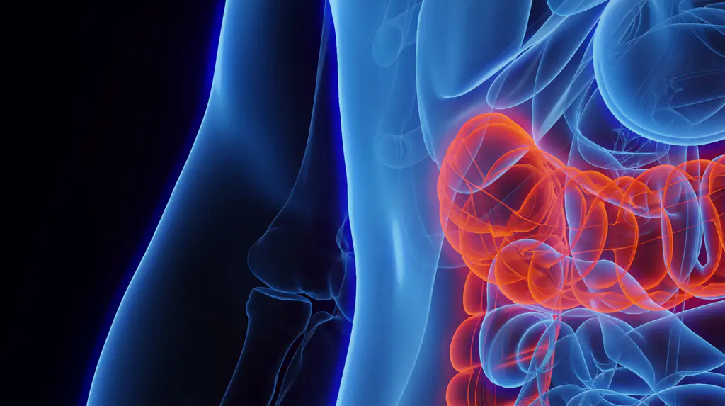 Colon cancer impacts over 100,000 Americans each year. Credit: SEBASTIAN KAULITZKI/SCIENCE PHOTO LIBRARY/Getty