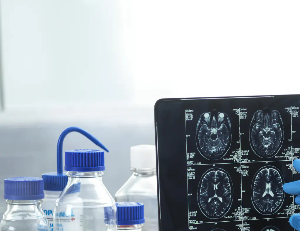 A man was diagnosed with dementia at 49. Credit: TEK IMAGE/SCIENCE PHOTO LIBRARY / Getty