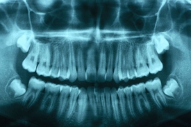 Woman, 23, issues urgent warning as she reveals she nearly died after common issue with wisdom tooth