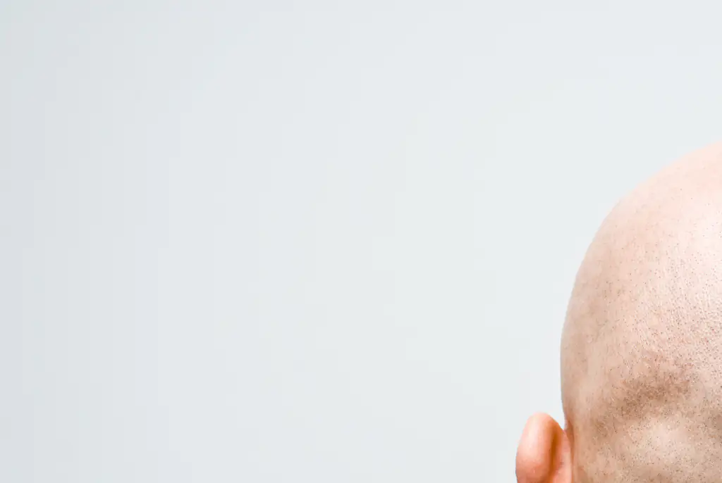 Calling a man 'bald' can be considered sexual harassment, High Court rules