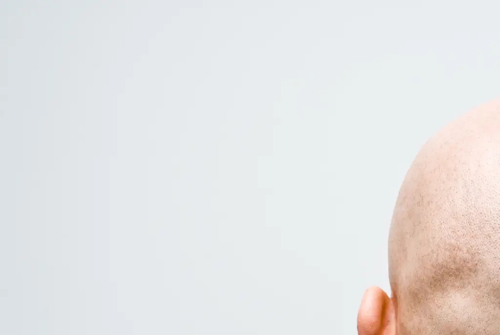 Calling a man 'bald' can be considered sexual harassment, High Court rules