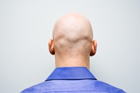 Calling a man 'bald' can be considered sexual harassment, High Court rules