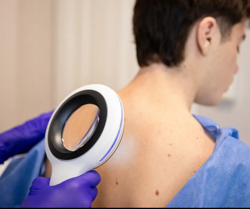 Doctor shares disturbing video of most severe skin cancer he's encountered and issues urgent health warning - Article Image 2