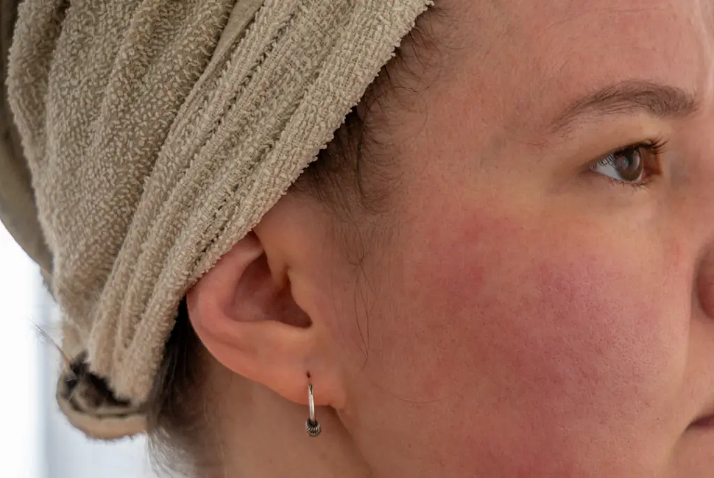 Bizarre reason why some people’s skin turns red when drinking alcohol