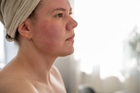 Bizarre reason why some people’s skin turns red when drinking alcohol
