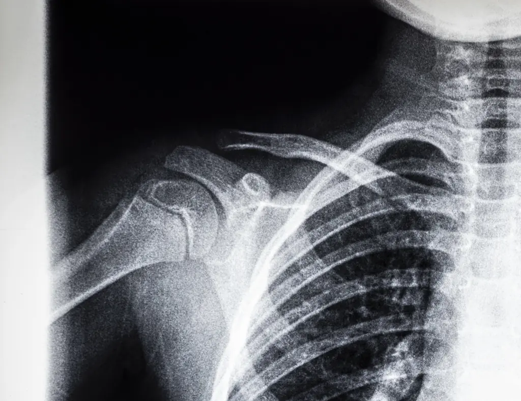 Man goes to hospital because his nipple is leaking pus: Doctors make horrifying discovery