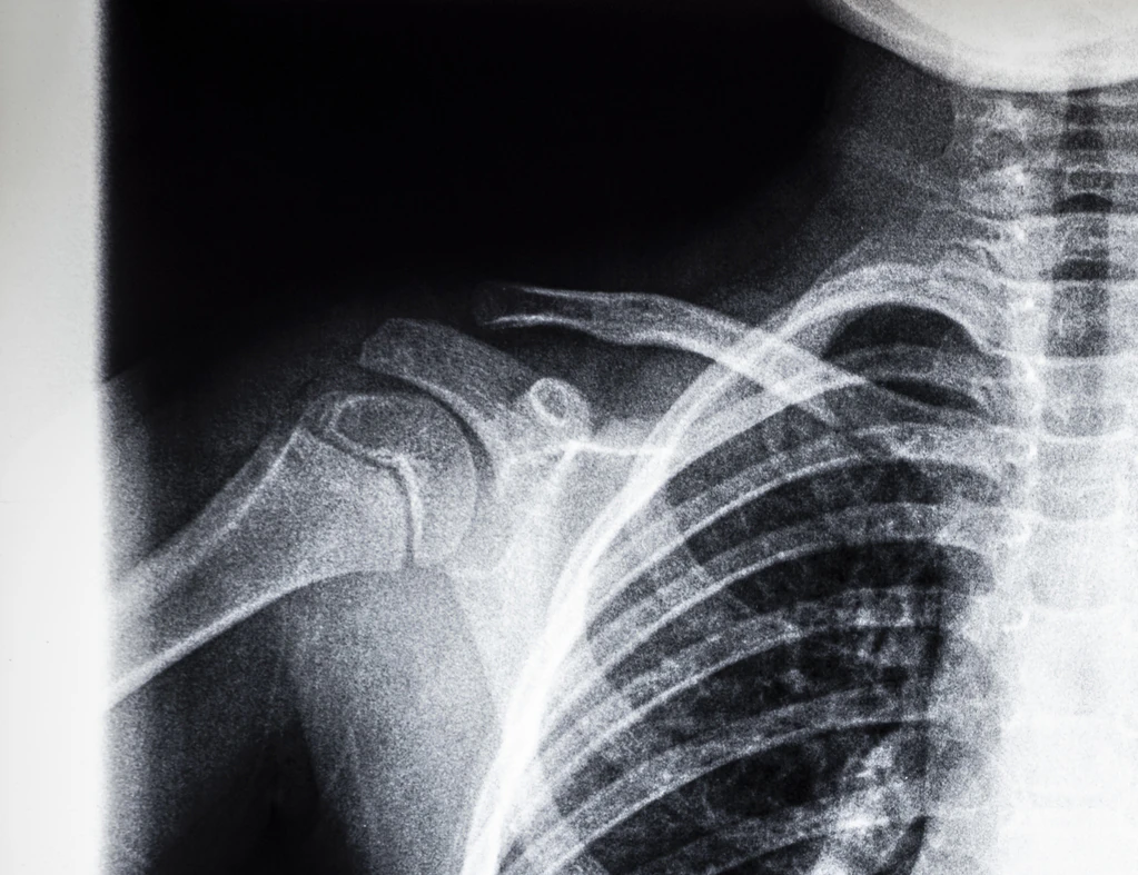 Man goes to hospital because his nipple is leaking pus: Doctors make horrifying discovery