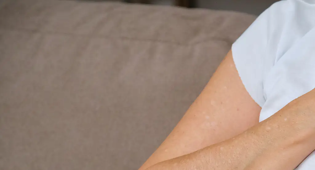 Woman, 46, reveals the symptoms she ignored before being hit with a heart attack