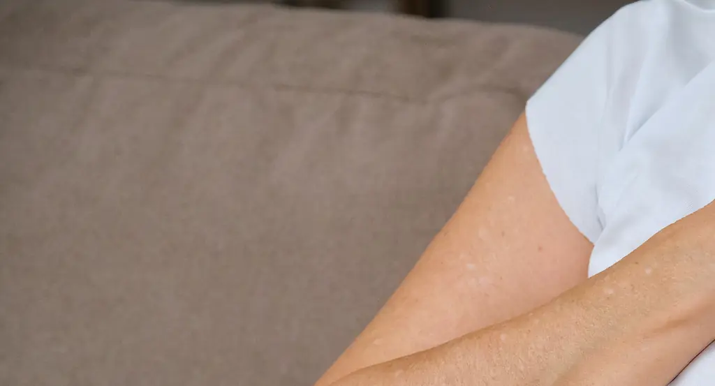 Woman, 46, reveals the symptoms she ignored before being hit with a heart attack