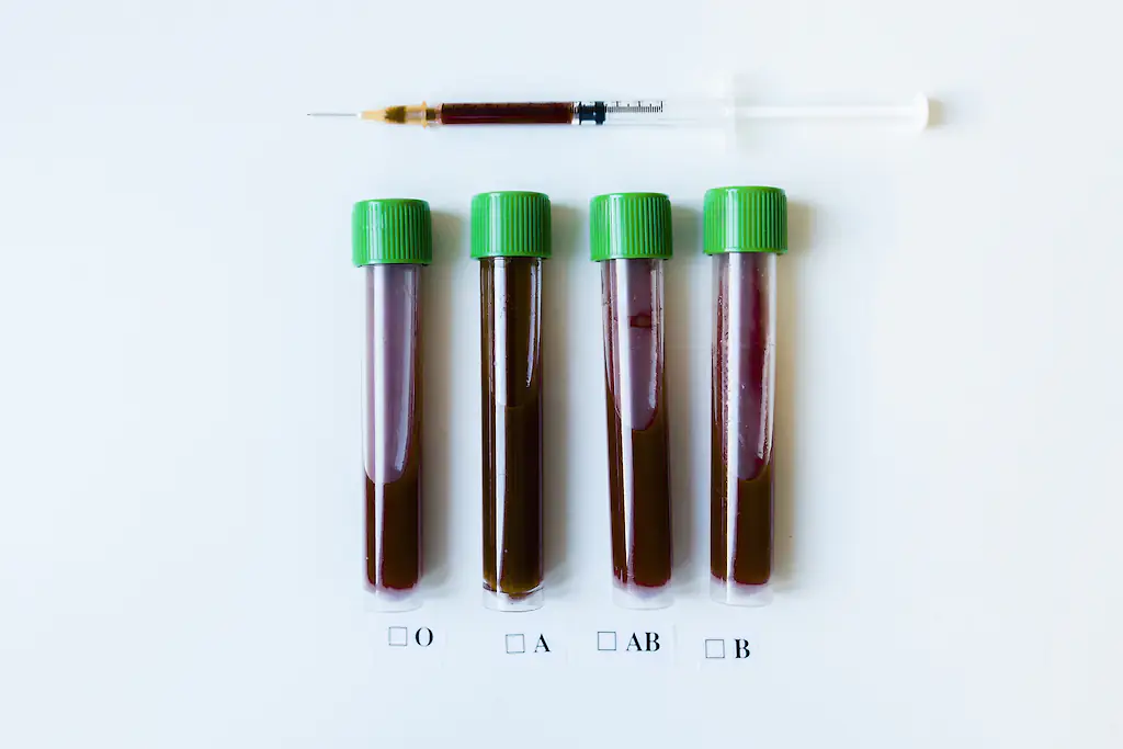 Blood group systems are essential for blood transfusions. Credit: Westend61 / Getty