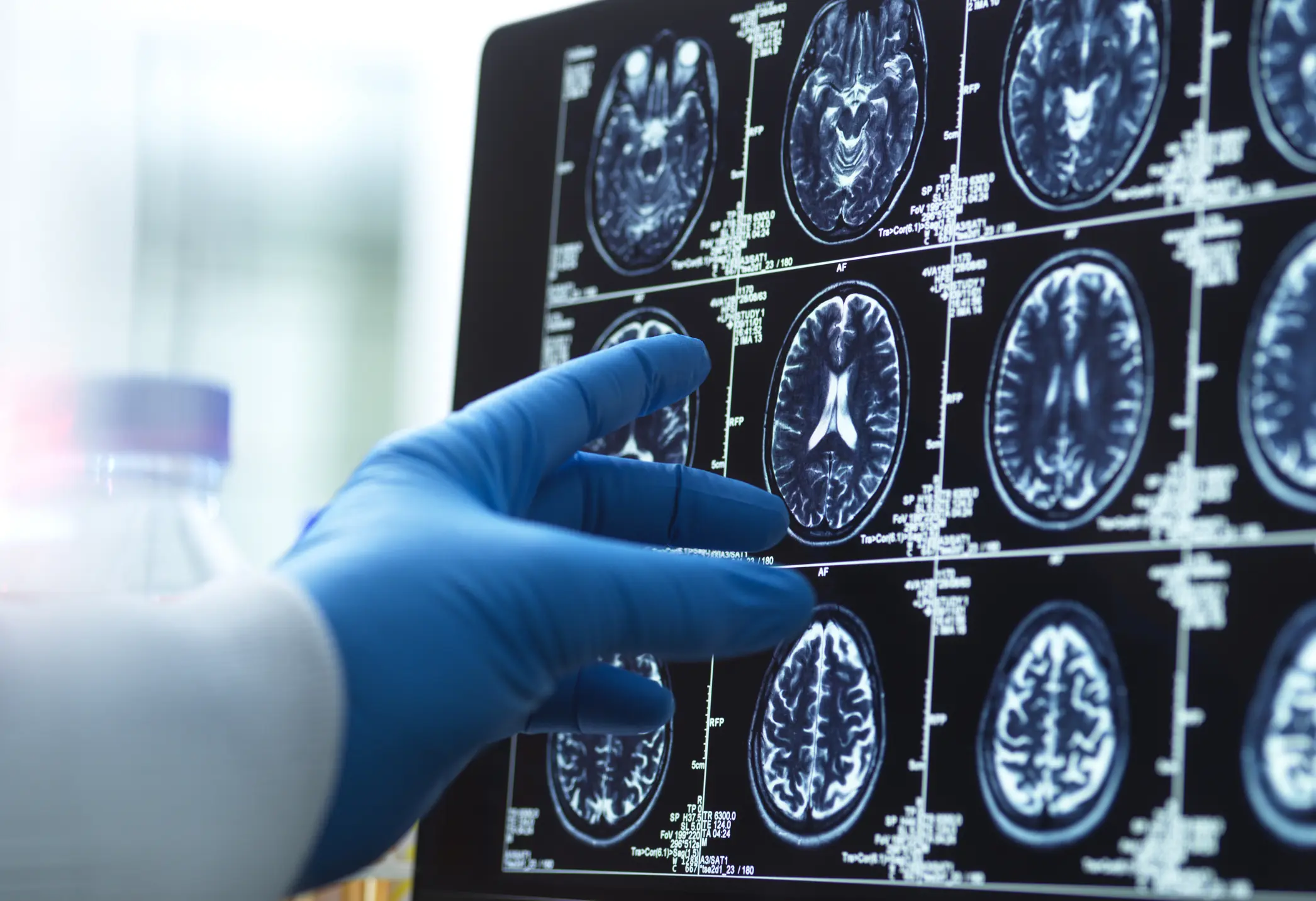 Researchers have been studying the brain. Credit: Andrew Brookes / Getty