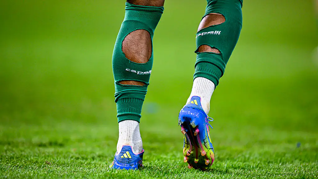 Reason World Cup soccer players are cutting holes in socks