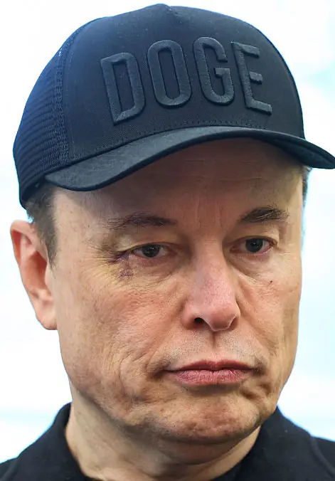 Elon Musk has revealed how he got his black eye. Credit: The Washington Post / Getty