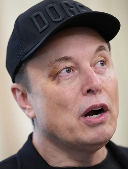 Elon Musk reveals how he really got black eye after sparking concern during Oval Office farewell - Article Image 1