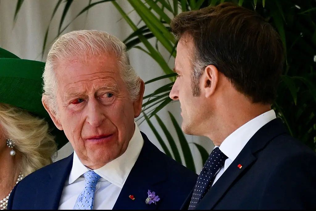 Buckingham Palace releases statement to address major concern over King Charles' appearance