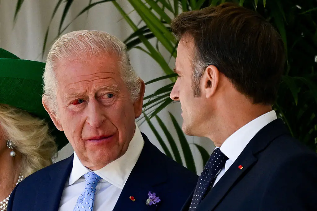 Buckingham Palace releases statement to address major concern over King Charles' appearance