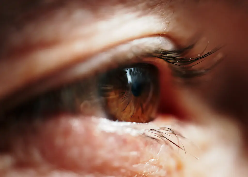 Eye floaters are usually harmless. Credit: 	Gary Yeowell/Getty Images