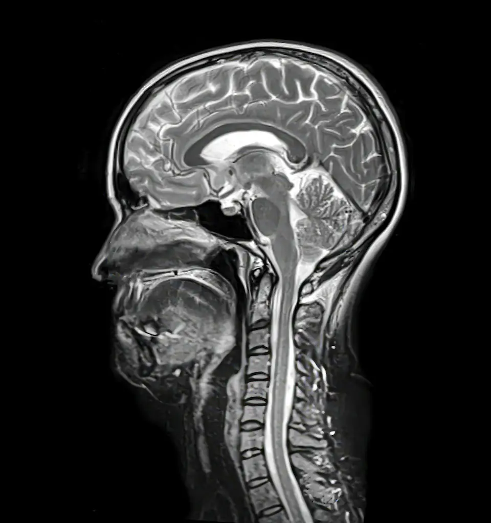 According to the brain, adulthood starts at 32. Credit: KATERYNA KON/SCIENCE PHOTO LIBRARY / Getty