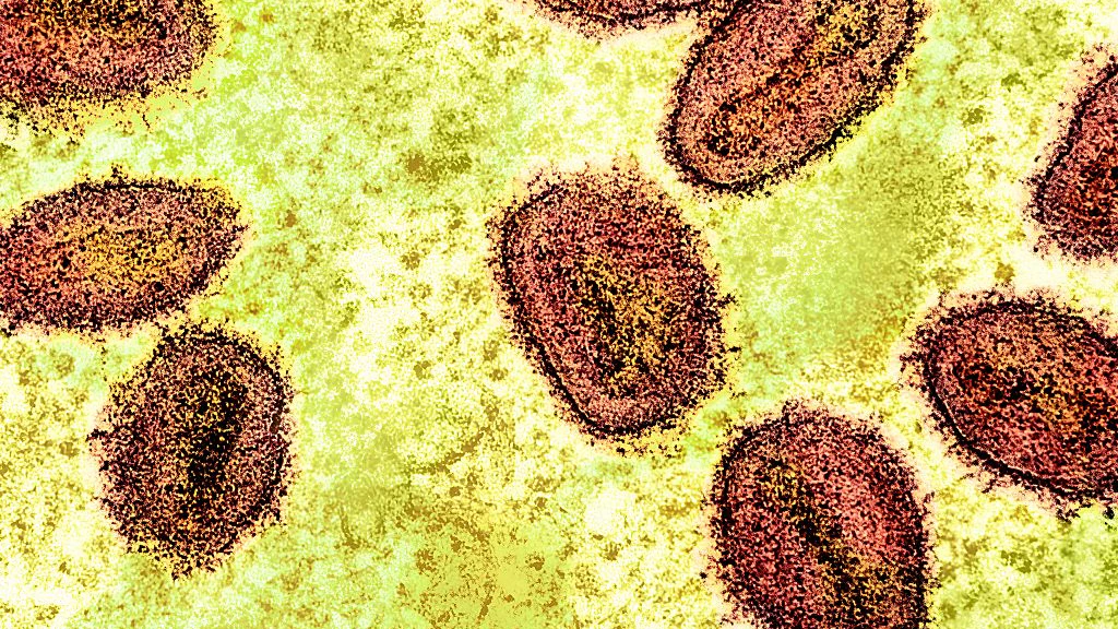 NIH-NIAID/Image Point FR/BSIP/Universal Images Group via Getty Images