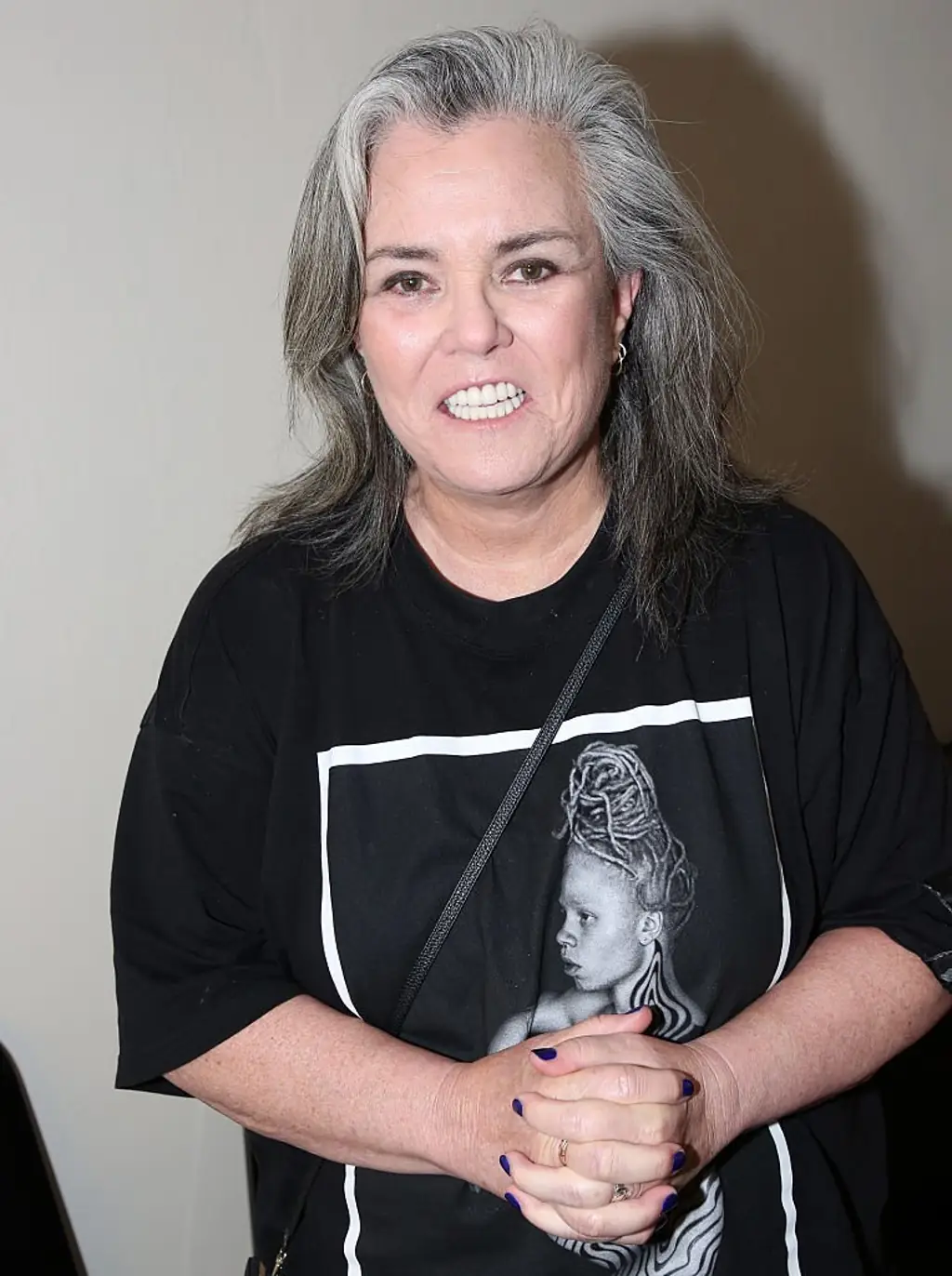 Rosie O'Donnell also spoke about her facelift. Credit: Bruce Glikas / Getty 