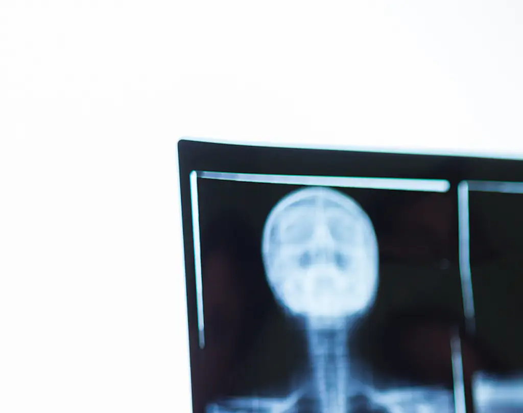 A woman has sent an urgent message to others after being unexpectedly diagnosed with stage-four cancer. Credit: Ilbusca / Getty
