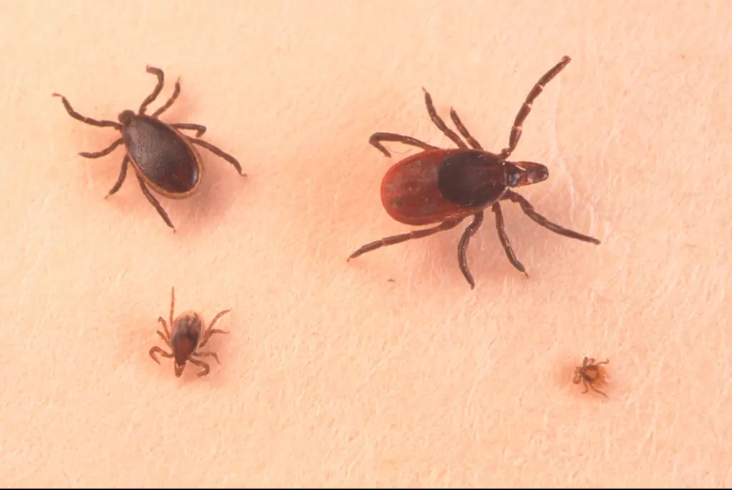 Lyme disease. Credit: Getty Images 