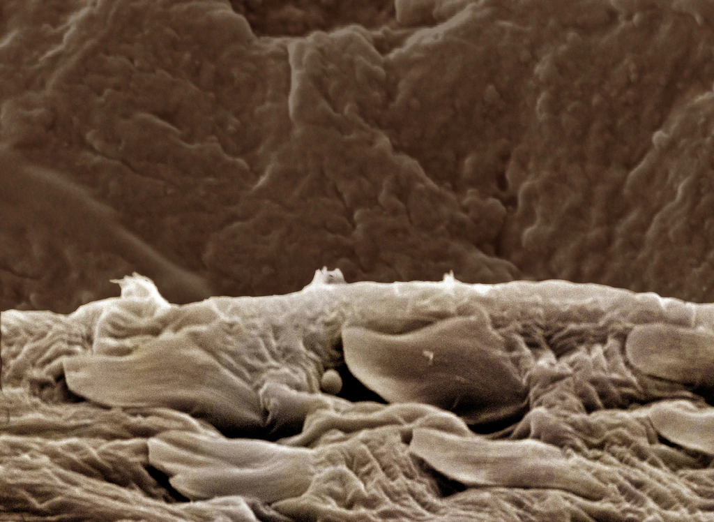 Creepy truth behind creatures which live and have sex on your face