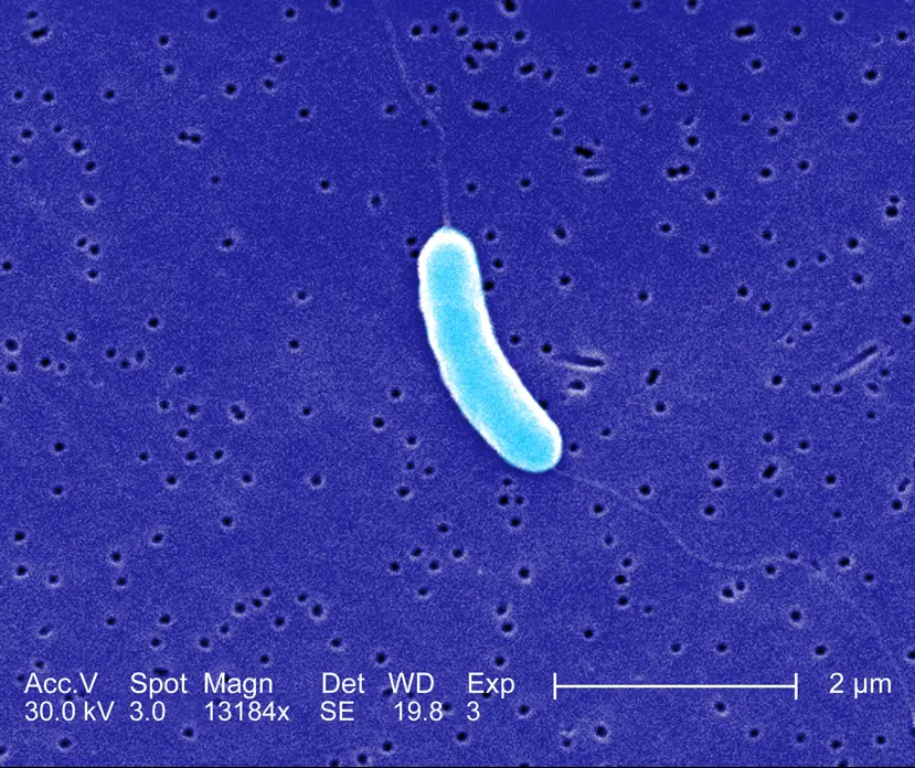 Rare flesh-eating bacteria kills four in Florida as health officials issue warning - Article Image 1