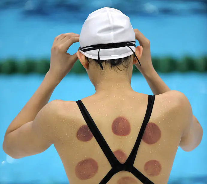 Real reason Olympic athletes have dark red cirlces on their backs