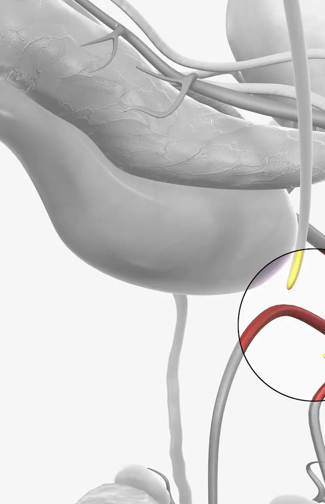 A vasectomy involves cutting and sealing the tubes which carry sperm, providing a permanent method of contraception. Credit: MedicalRF.com/Getty Images