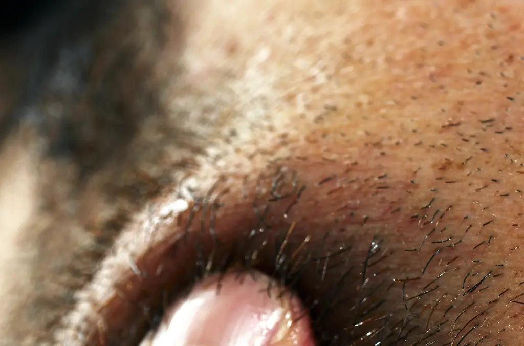 Student takes his own life after receiving beard transplant from 'estate agent posing as a surgeon'