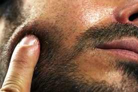 Student takes his own life after receiving beard transplant from 'estate agent posing as a surgeon'