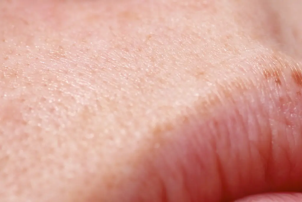 Reason why people get little white bumps on their lips and privates