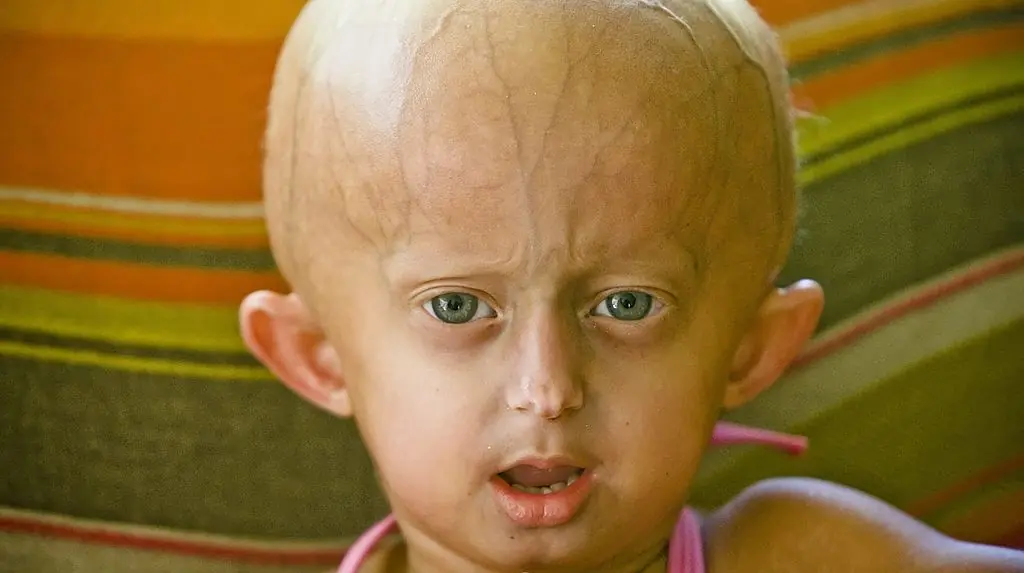 Beandri Booysen has died aged 19. Credit: Foto24/Gallo Images/Getty