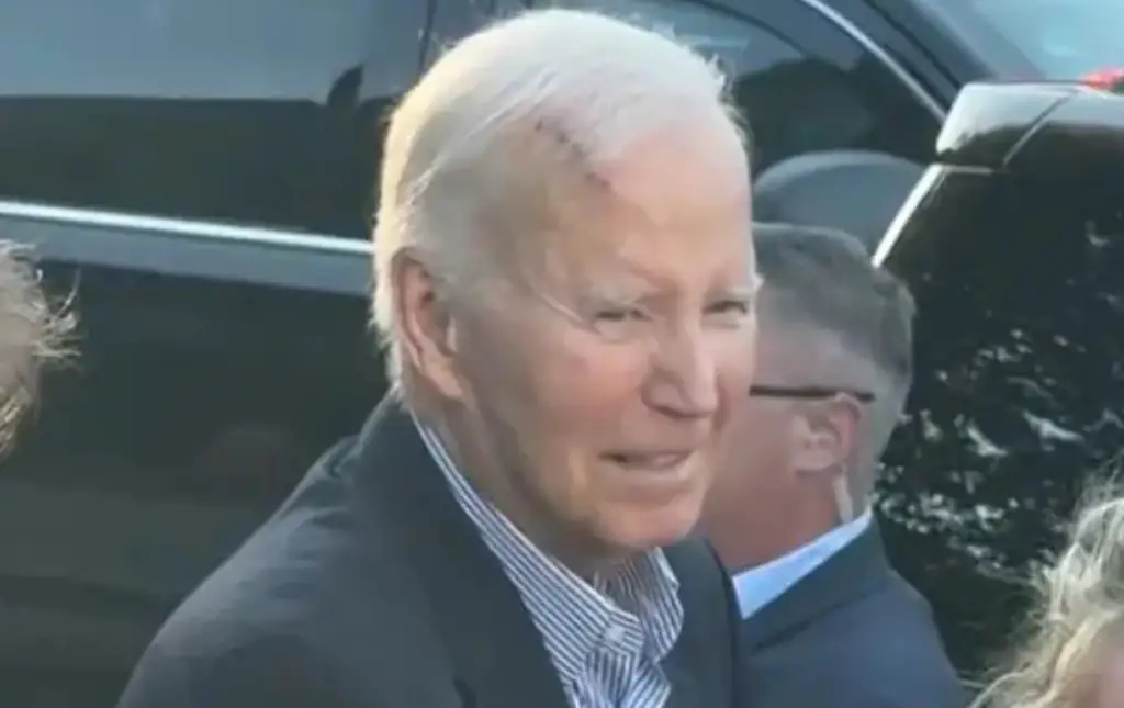 Joe Biden spokesperson confirms rumors after former US president was spotted with giant bandage on head